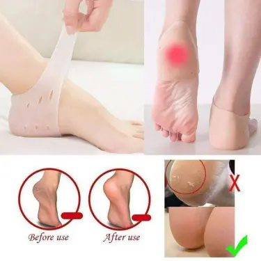 كعب السيليكون الطبي Comfort Heel Cup